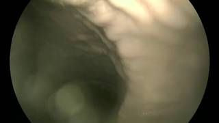 Dolphin endoscope