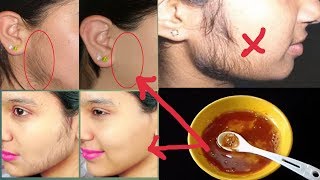 ৫ মিনিট ঘরে বসে মুখের অবাঞ্ছিত লোম চিরতরে দূর করুন। পার্লারে যেতে হবে না। Sanjida Beauty Tips