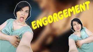 Engorgement et allaitement à quoi le reconnaître et comment y remédier ? -Apasdemoa-