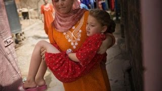 QADIN SÜNNƏTİ nədir?