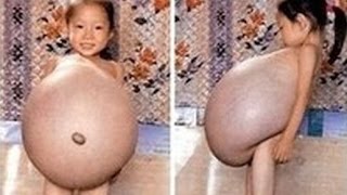 ДЕВОЧКА РОДИЛА в 5 ЛЕТ! САМАЯ МОЛОДАЯ МАМА В МИРЕ - Лина Ванесса Медина