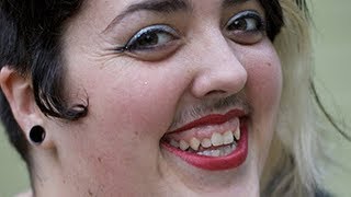 БАЪЗИ АЁЛЛАРГА НЕГА МУЙЛОВ ЧИКАДИ КАНДАЙ ДАВОЛАШ МУМКИН