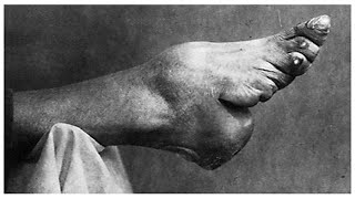 The Real Reason Why Chinese Women Bound Their Feet