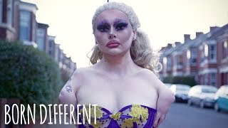 The Armless Drag Queen | BORN DIFFERENT