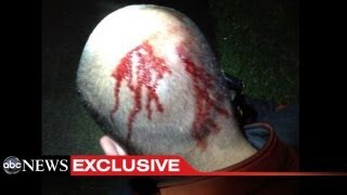 New George Zimmerman Photo, Bond Hearing