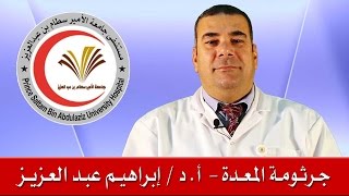 جرثومة المعدة - تثقيف صحي - مستشفى جامعة الأمير سطام بن عبد العزيز