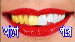 মাত্র ৩ মিনিটে হলুদ দাঁতকে সাদা করুন । 100% কার্যকরী