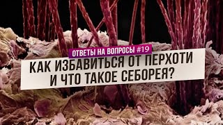 Перхоть: как победить и как предотвратить (Ответы на Вопросы)