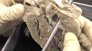 Sheep Heart