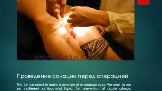 Пластика препуциального мешка