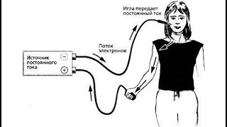 Метод Рагеля плюс или минус