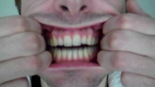 REVERSE CAVITIES WITH FOOD AND SUPPLEMENTS