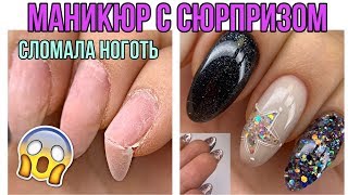 Это больно?Ноготь висит на гипонихии?Маникюр с сюрпризом
