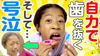 自力で抜歯する小3女子！そしてその後まさかの事件勃発で大号泣するミーミ?一体何が!?