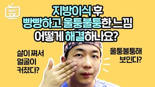 지방이식부작용 어떻게 해결해야 할까?