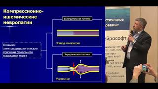 Э.Ю. Малецкий "Роль УЗ исследования в диагностике поражений периферических нервов"