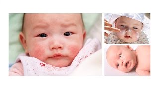 Mẹo Dân Gian Bôi Một Lần Ăn Ngay Giúp Con Mùa Đông Không Còn “má Nẻ Cà Chua”✔