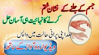 Jalne K Nishan Khatam Karne Ka Totka |Health Tips In Urdu