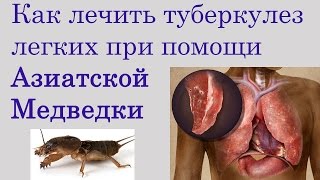 Как применять медведку при лечении туберкулеза легких