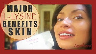 ? ⭐️ ?  L-Lysine! Rad skiN +viral ?? help+plaque+ & MORE   ?