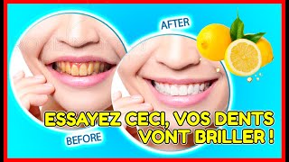 EChangez les dents jaunes en blanc nacré: blanchir les dents à la maison (100% rapide)