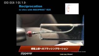 【歯科】スピード根管治療