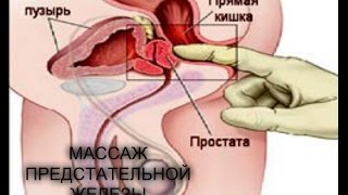 Массаж простаты самостоятельно дома  Как самому сделать массаж простаты  Стимуля