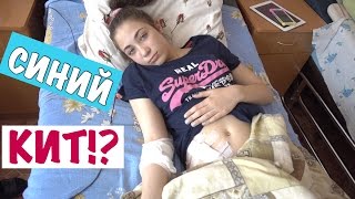 СИНИЙ КИТ!? ПОСЛЕ ОПЕРАЦИИ/ Я НЕ В ИГРЕ