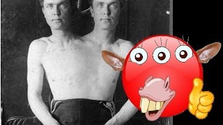 Жуткие цирковые актеры уроды, с отклонениями, патологиями и дефектами, старые фото