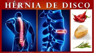 Hérnia de Disco | Como Acabar com Dor nas Costas
