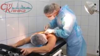Кожные заболевания