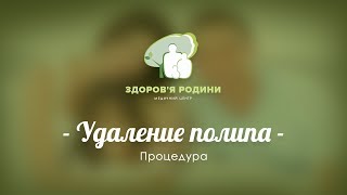 Удаление полипа МЦ "Здоров'я родини"