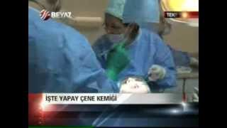 Yapay çene kemiği nasıl yapılır , box teknik nedir , implant nasıl yapılır - Tanfer Klinik