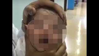 Saudi nurses sacked for squashing baby&apos;s head