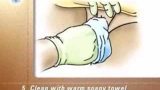 Discharge Vaginal, Female Perineal Wash PostCare™ Basic Center: