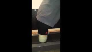 DAK  amputee Walking on stubbies (treadmill)