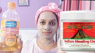 World's most powerful Facial ?| Pimples, Acne, black spots दाग धब्बे  झाइया को ज़ड से खत्म करें |