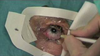 Intravitreal eye injection
