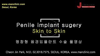 Penile implant sugery Skin to Skin  팽창형 음경임플란트 수술 풀영상