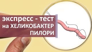 Тест на Хеликобактер пилори. ? Как делают уреазный экспресс - тест на Хеликобактер пилори?