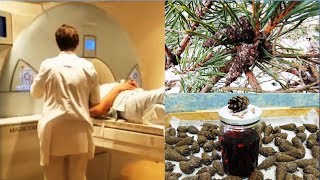 ? Инсульт. Время сбора зрелых шишек ? сосны. (Stroke - NO).