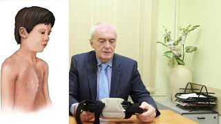 ОРТЕЗЫ при килевидной деформации грудной клетки. Ортез.дети.