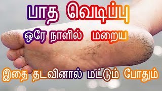 Home remedies for Cracked Feet/Heels in Tamil - பாத வெடிப்புகள் மறைய  Foot Crack -Tamil Beauty Tips
