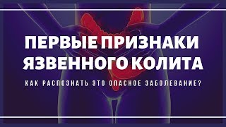 Признаки язвенного колита. Как выявить это опасное заболевание?