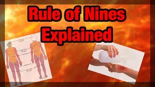 Rule of 9’s Explained and Made EASY (Adult Version)