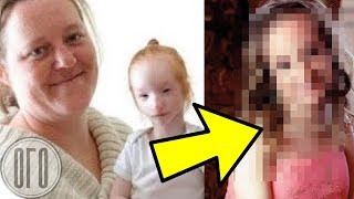 Ее Никто Не Желал Удочерять...20 Лет Спустя Вот Как Она Выглядит!