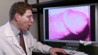 Extreme Diagnosis: Std's of the Penis