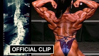 The Truth About My Back!  Pro female bodybuilder Denise Masino tells how she deals with Scoliosis