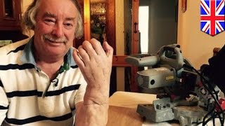 Мужчина отрезал себе руку бензопилой и даже не заметил