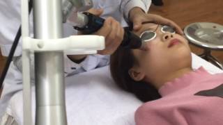 Căng da mặt Ultherapy không phẫu thuật tại Thẩm mỹ Hoàng Tuấn